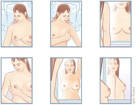6 passaggi per l`auto-esame del seno
